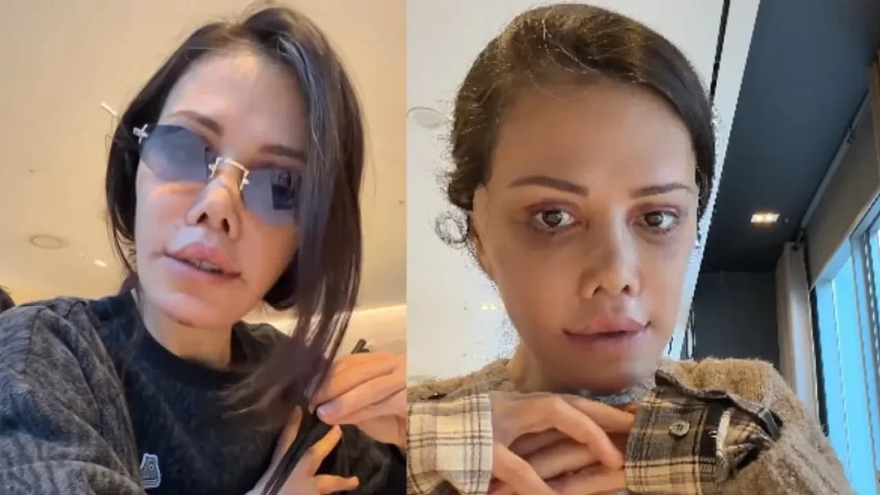 Didem Ceran'dan Dikkat Çeken 'Yüz Nakli' Çıkışı: "Para İçin Referans Olmam"